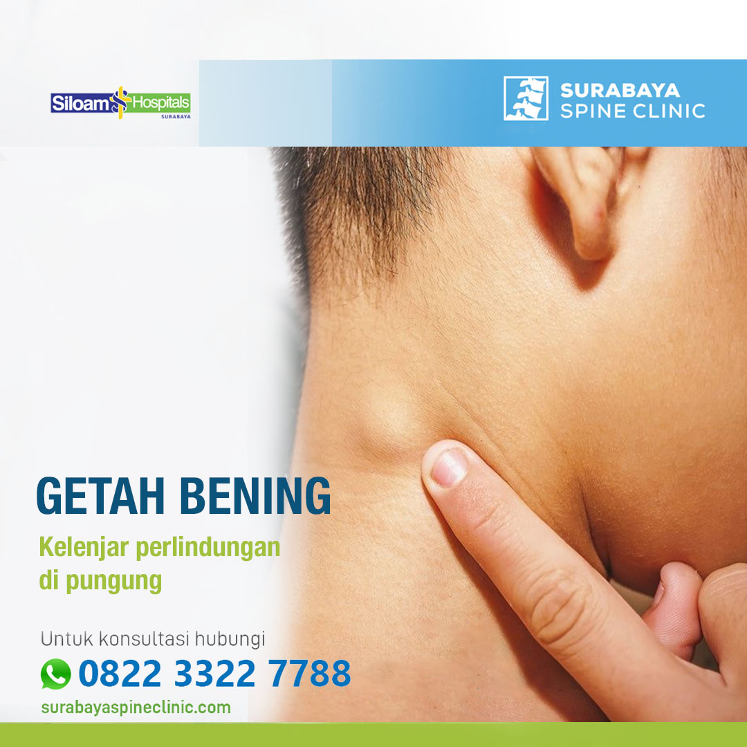 Kelenjar Getah Bening di Punggung 